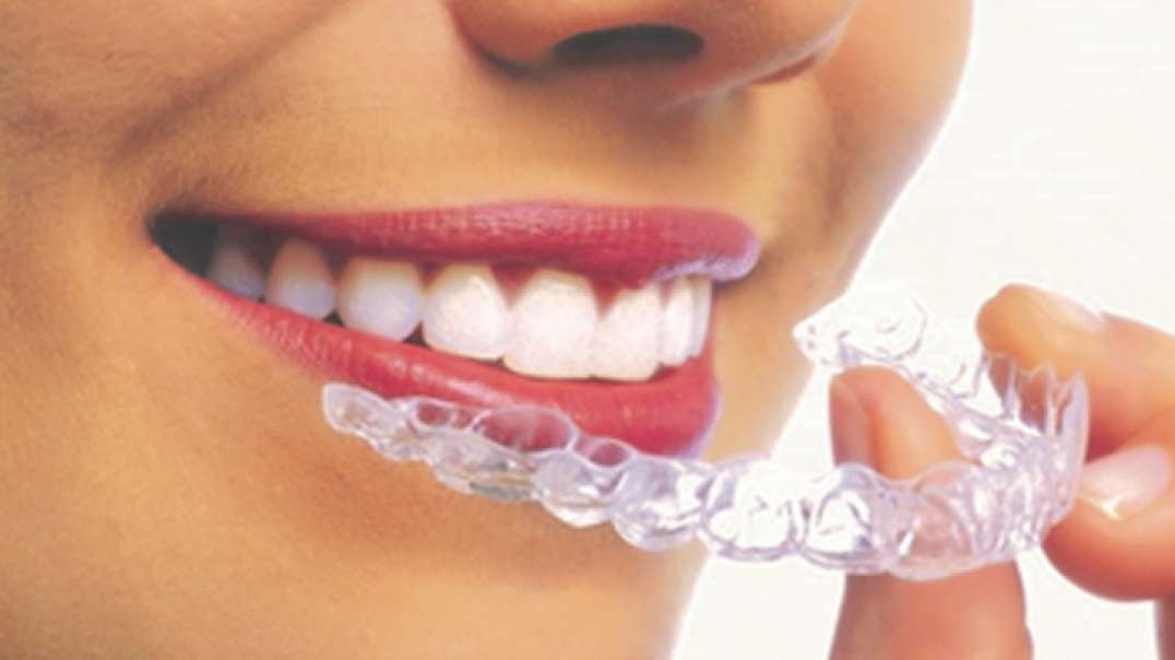Mancia Orthodontics - Best Invisalign Treatment in Miami, FL