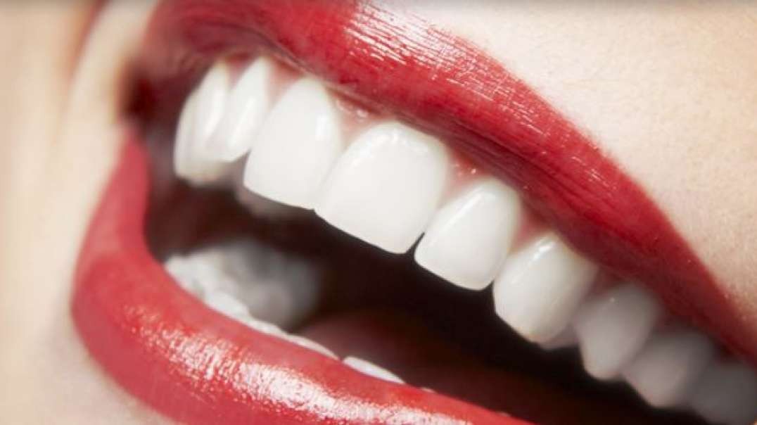 Smile Plus | Teeth Whitening in Homestead, FL