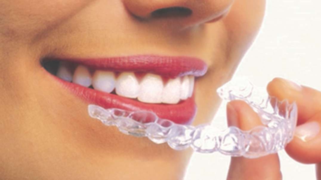Mancia Orthodontics : Best Invisalign Braces in Miami, FL