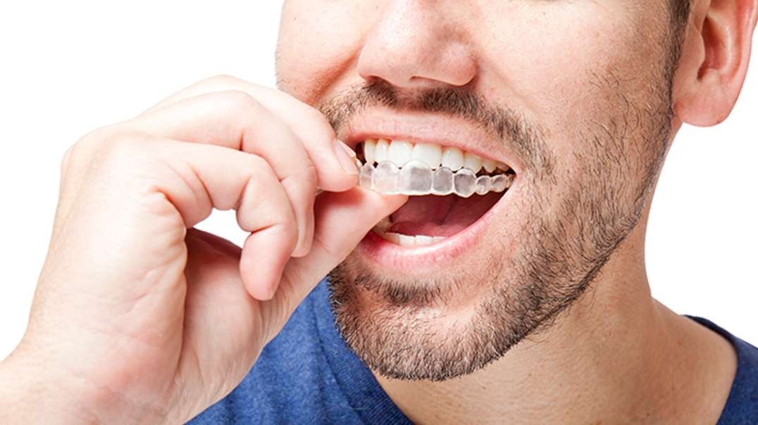 Mancia Orthodontics : Clear Braces in Miami, FL | 33144